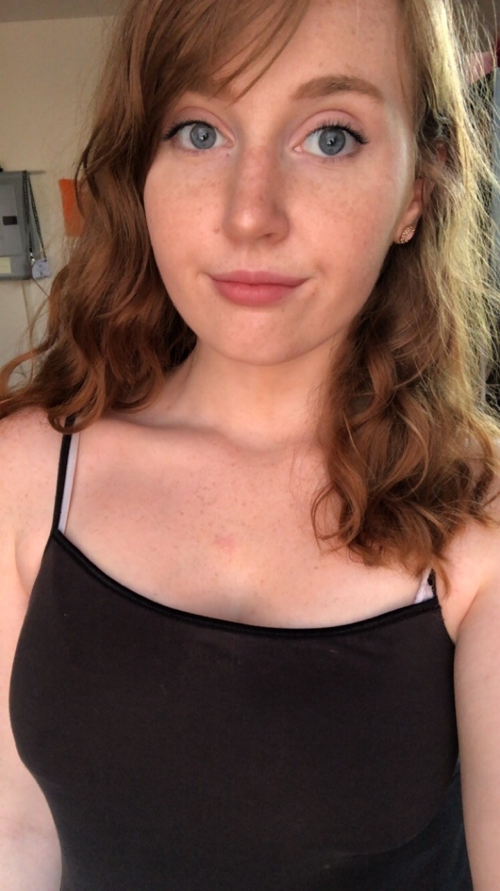 yesgingerfriend:  freckledlittlefairy: a very pink girl Klasse Sommersprossen