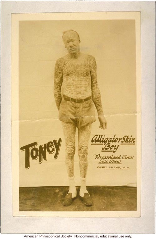 carnytrash:  resonanceinthehalls:  Vintage Photography of Circus ‘freaks’ and