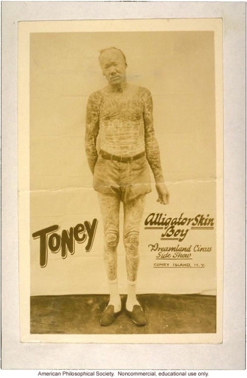 carnytrash:  resonanceinthehalls:  Vintage Photography of Circus ‘freaks’ and attractions.   The seventh photo is actually a still from the film Freaks, and despite the insistence of people using that terminology, it’s quite derogatory.  Though