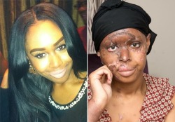 hoeonthelow:  therealleaah:  My prayers go out to the beautiful Naomi Oni I have been looking up things about this all day today a “friend” of hers threw acid on her face because she was jealous of her smh  reasons #436 why i dont trust any of you