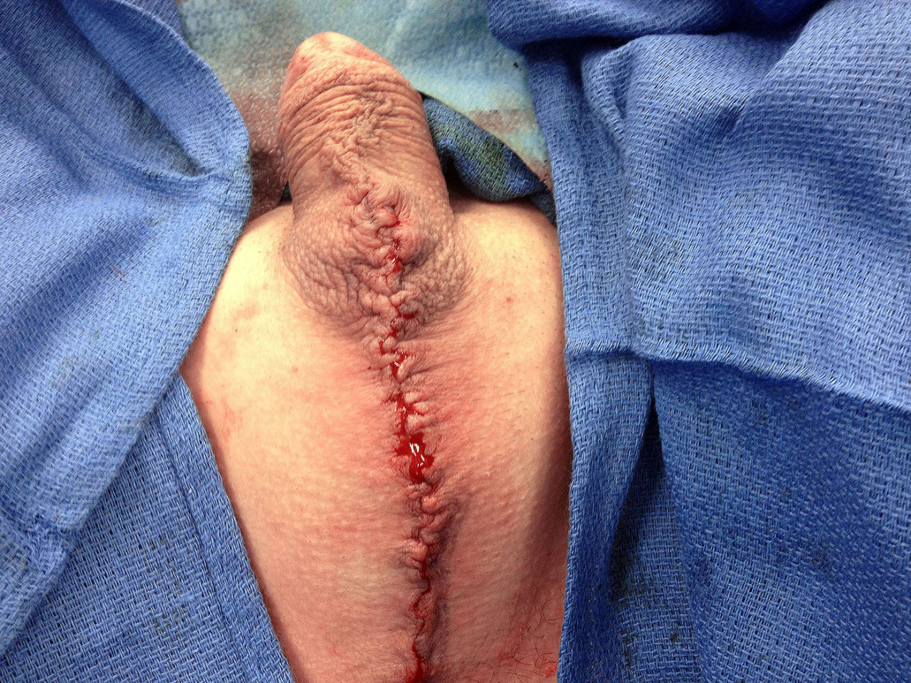 rexxime:  SISSY-CLIT IN THE MAKING m2f trans same person pre and post orchiectomy.