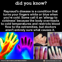 did-you-kno:  Raynaud’s disease is a condition that  turns your fingers white or blue when  you’re cold. Some call it an ‘allergy to  coldness’ because the body overreacts  to cold temperatures and restricts blood  flow to the extremities, but