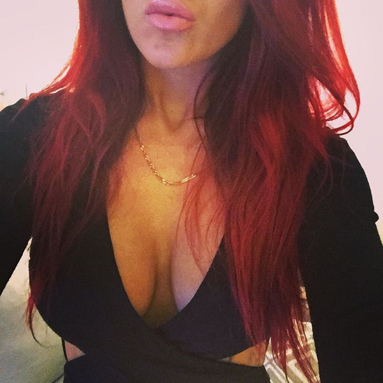 amateur-implant-pics:  charlotteschou0