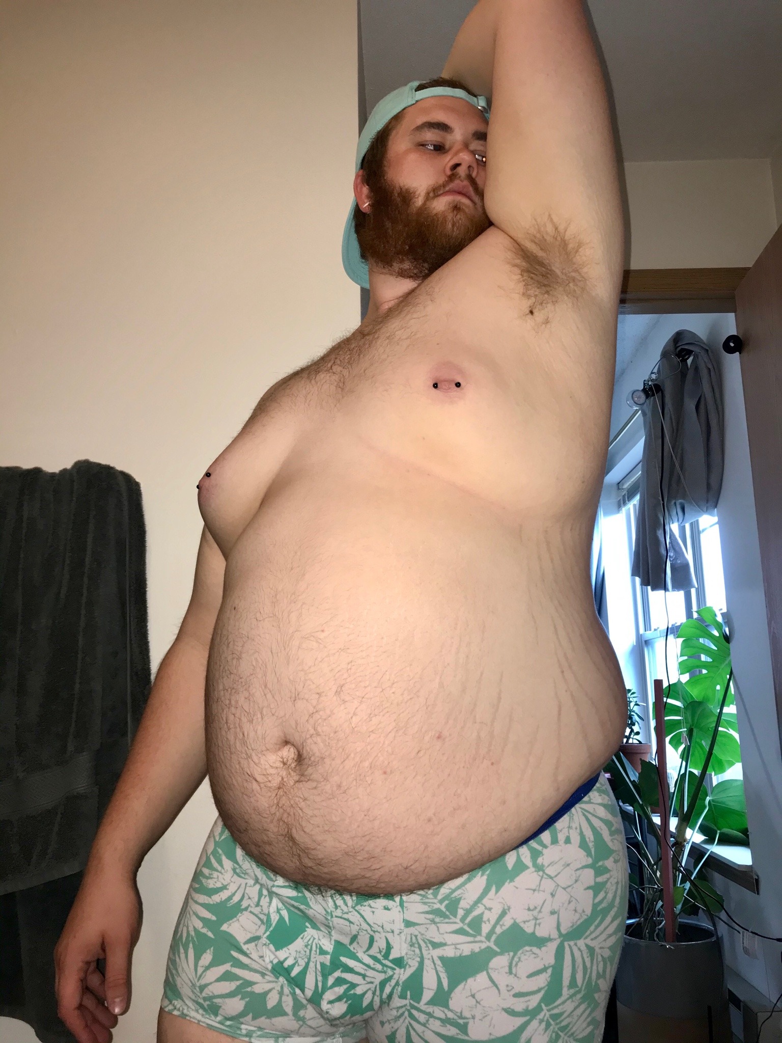 chubbyal:Stretchmark wonderland 