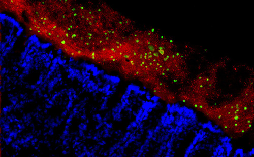 currentsinbiology: Intestinal fungi may aid in relief of inflammatory disease Fungi that live in a