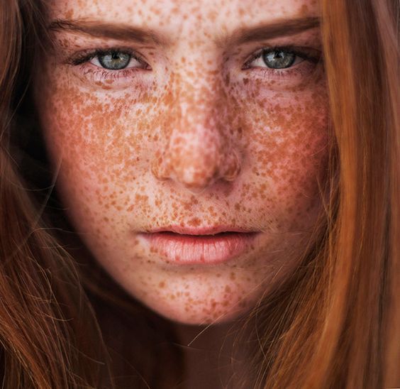 furrycollectionperson-things:Freckle face