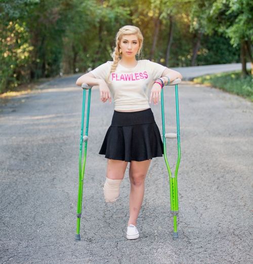 mamo1leg: prosthetic-life: ilampmta: Wow she is really pretty! ES ? I don’t think that it is E