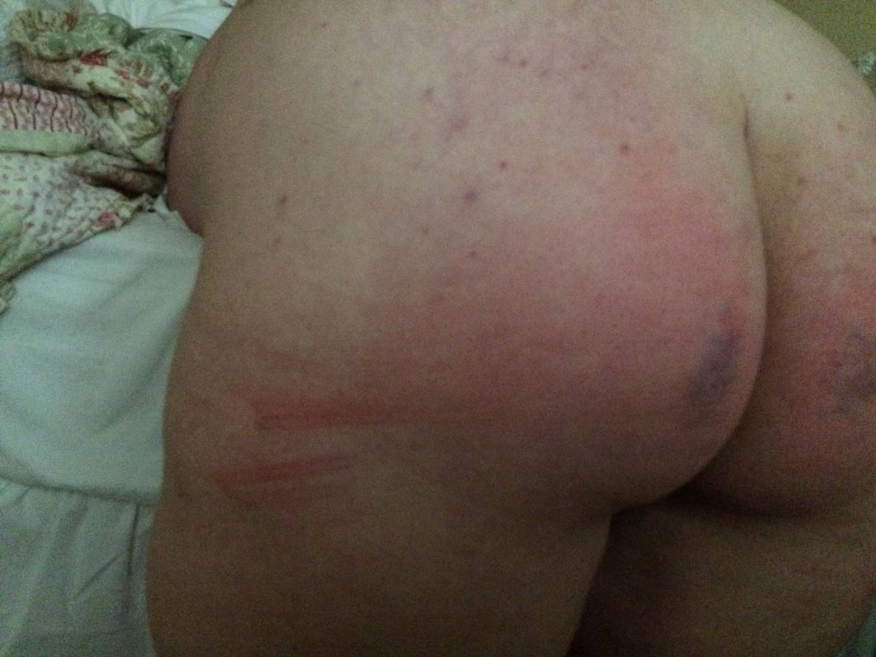scarletslutmolly:  Birthday caning, Part 2. I honestly lost track of how many strokes/minutes.