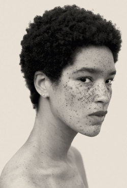 dillonhilton:  s0mmerspr0ssen:   For his recently published picture book Freckles (Splice Pictures Publishing), the Swiss photographer Reto Caduff has taken pictures of freckled women all over Europe. His pictures prove: freckles are beautiful. Don’t