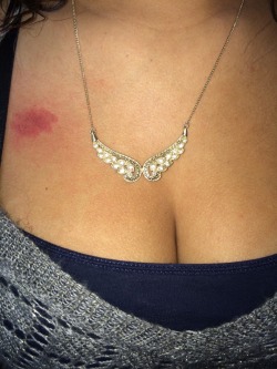 yourbabygirl12:  #today #hickeys #SexualyFrustrated