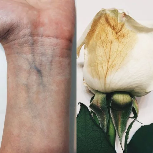 poi-scappiamo:  Body comparative Iris: blooming-buds