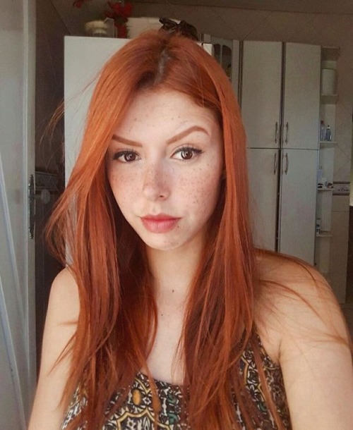 redhairzz:@ruivacrf Schöne Sommersprossen
