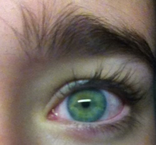 vipeur:  my eye unedited 