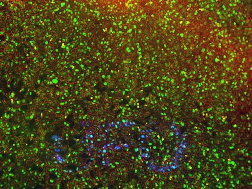 bpod-mrc: UFO Sighting Finding out the molecular mechanisms that make some cancer cells particularly