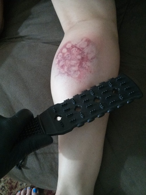 gothicdiscordian: littlefeministbitch:The process of marking my right calf over the Fourth of July