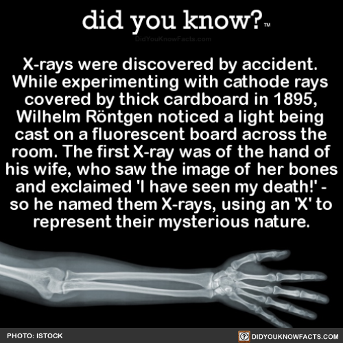 did-you-know:X-rays were discovered by accident. While experimenting with cathode rays covered by th