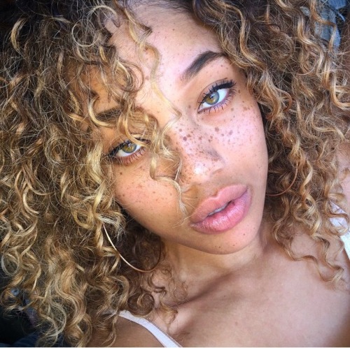 deerspace: forjeditorap: Glorious Melanin Your freckles give me goosebumps,you’re gorgeous