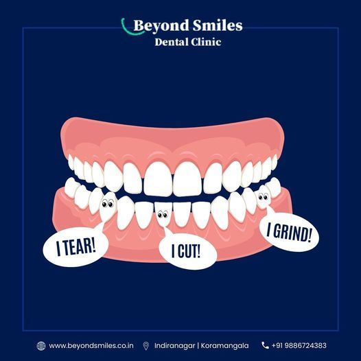 Best dental clinic near Indiranagar Bangalore – @beyondsmilesbanglore on Tumblr