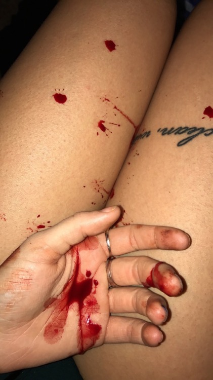 I got four nose bleeds today, and am genuinely concerned for my health. But hey I like this picture.