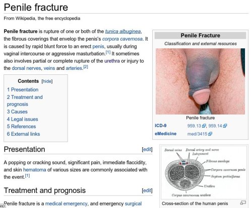 xtratitillating:  jollymann:  bustymcblowjob:  sluttraining:  Hello my little sluts :-)   I noticed that some of you have started to follow this blog. I am glad. In a previous post I showed you the right angle when fucking on top. Why? Because the penis