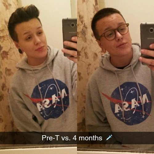 Forgot to post this a month ago. #throwback #4months #ftm #testosterone #trans #transguy #comparison