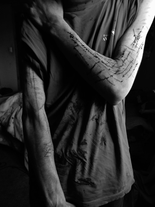 humandisasterss:  Photo session with my boyfriend 