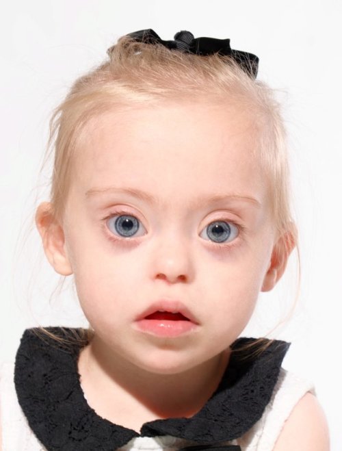 huffingtonpost:  Connie-Rose, Toddler Model With Down Syndrome, Wins Hearts EverywhereAt nearly two years old, Connie-Rose Seabourne is already changing the world one smile at a time. The British toddler, who was diagnosed with Down syndrome just two
