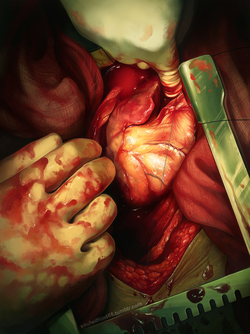 soulwithin465: Heart trauma from a stabbing.