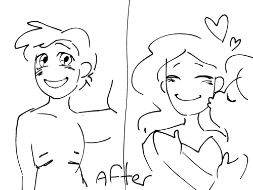Transphobes Will Take Before And After Transition Photos Of Trans People And Be Like "look How Happy