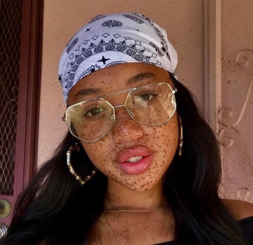 itsjustsodope: Beauty in the Youth.