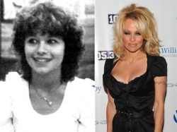 10Knotes:  You Won’t Believe Which Of Your Favorite Celebs Have Had A Nip And Tuck!