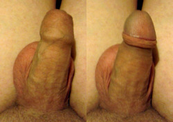freethebellend:  This pic is still uncircumcised
