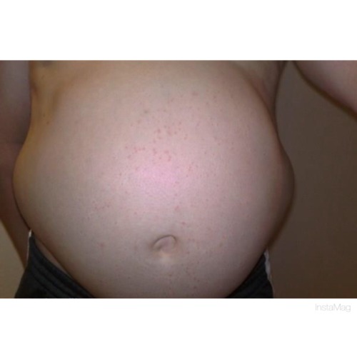 blogartus:  Incredible belly on average-size guy. A morph? Pregnant with quadruplets? How do you hide this in everyday life?