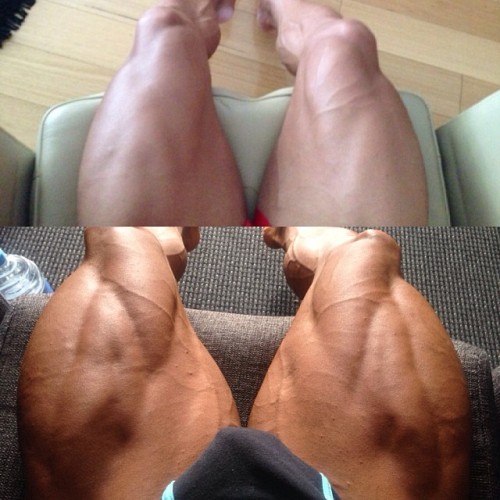 drwannabe:  Aaron Polites’s leg development.  pics are 13 months apart