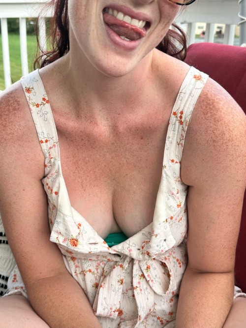 Happy Sunday Views … Reblog If You Love Freckles