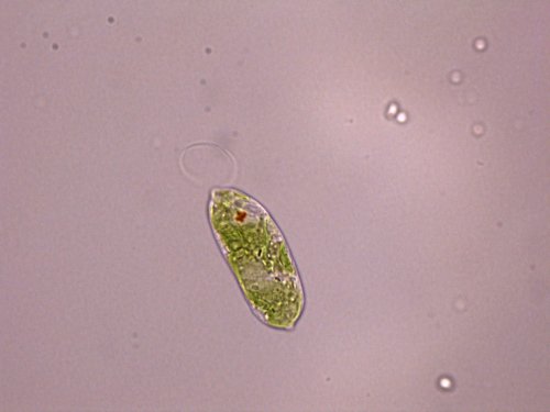 Super algaeThe image above shows Euglena gracilis, a single-cell algae lurking in garden ponds.It mi