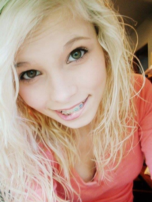 Cute teens with braces facial