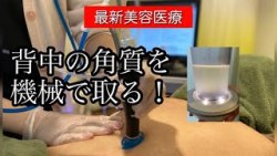 角栓背中tumblr Posts Tumbral Com 角栓背中tumblr Posts Tumbral Com