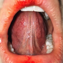 paleskinandbruisesaddict:  I bite my lips