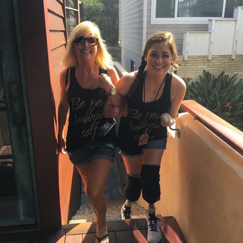 ilampmta: Very pretty girl! Love her prosthetic legs and her wrist stumps! So cute!