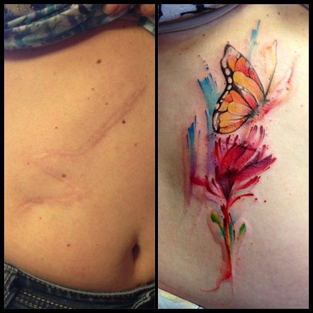 hentai-ass:   tattoo-queens:  skindeeptales:  Amazing scar covering tattoos  Tattoos