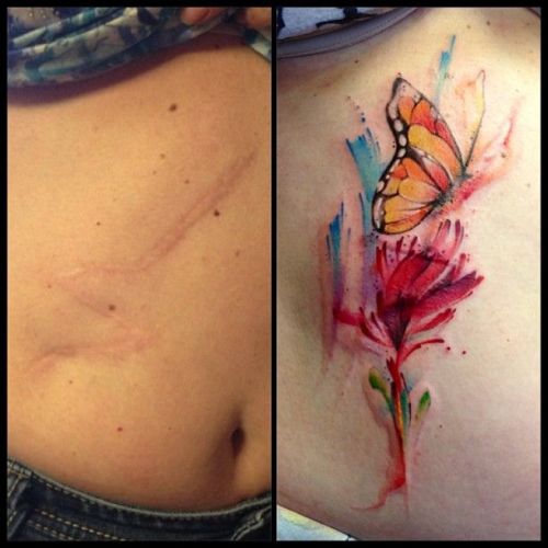 Porn skindeeptales:  Amazing scar covering tattoos photos