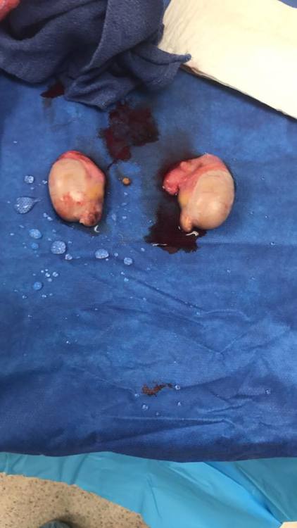 split6: A picture of my shrunken nuts after they were removed.  I wish I could have seen them f