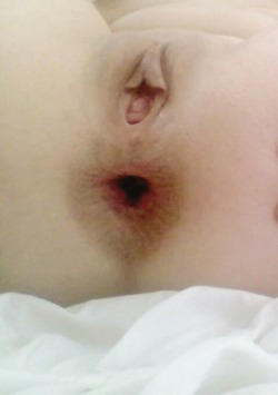 submrs:  …and another of my lovely holes…having
