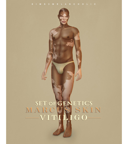 download \ credits: @obscurus-sims​​ & @ddarkstonee​​ ♡ \ info:marcus skin vitiligo - 4 versions