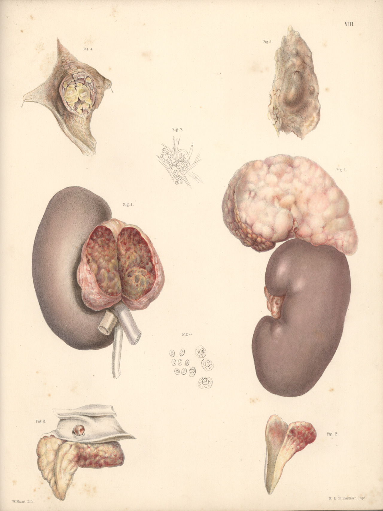 trinaechidna:  Hand-colored monograph from Thomas Addison’sOn the constitutional