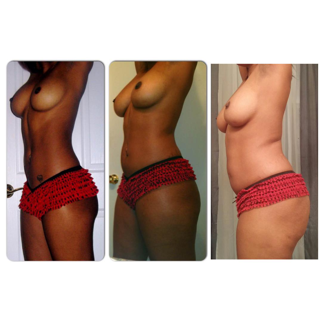 darlingabby:  This is my slow progression into being overweight 😞. Sigh. As you