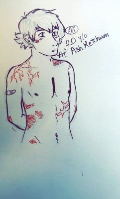 freakkingalex:I drew 20 year old Ash from the fanfic “Returning Home”!! Really good ff, I really recommend it.  Since he was a victim of lighting I thought I’d give him a bit of scars and of course just some bruises because he’s a reckless adult.