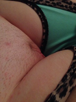 Teenhasnoclue:  About To Eat This Pale Hairy Pussy