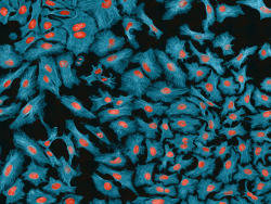 Ucsdhealthsciences:  Hela Cells, False-Colored. Image Courtesy Of Thomas Deerinck,